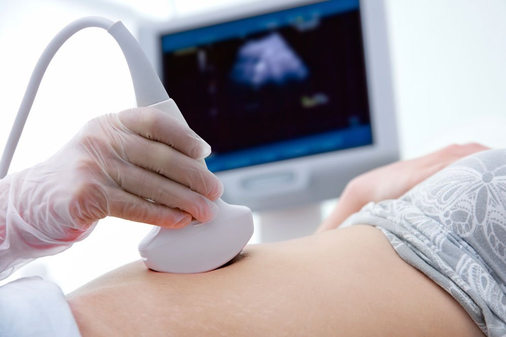 prenatal diagnosis